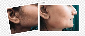 Female or Male Side Burns