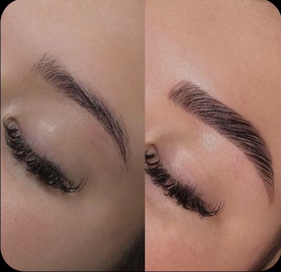 Brow Lamination