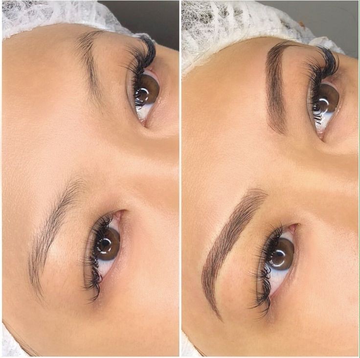 Microblading