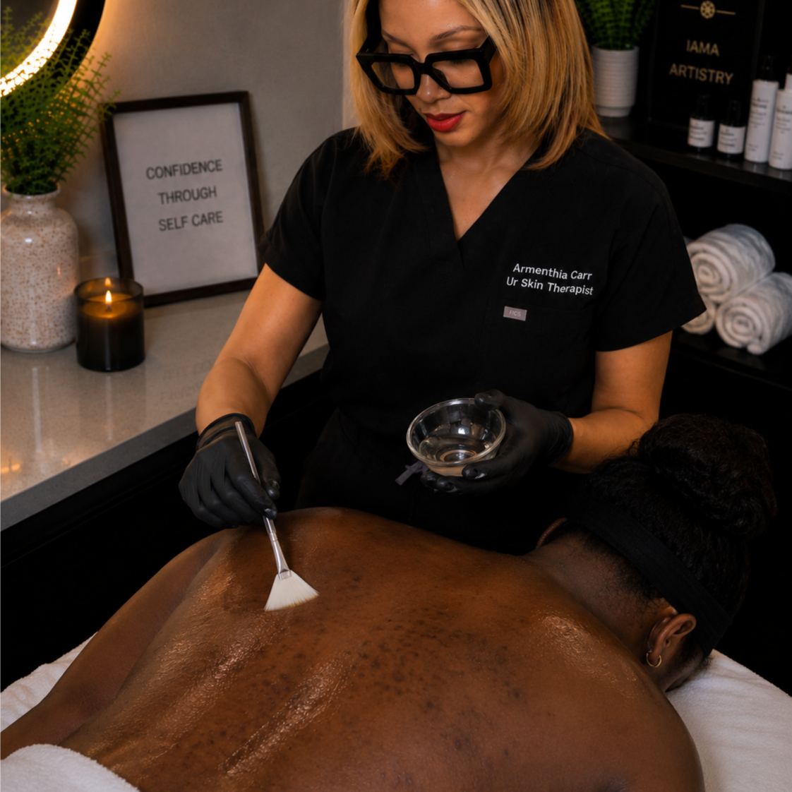 Ur Skin Back Chemical Peel at Ur Skin Therapist in Little Rock, AR