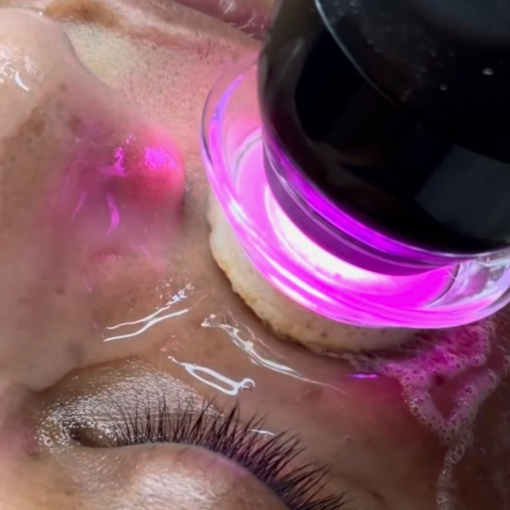 Glo2Facial 3 Options at Bare by Lanna in North Reading, MA