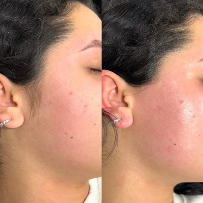 Full Face Wax at VeleaRaeStudio in Tempe, AZ