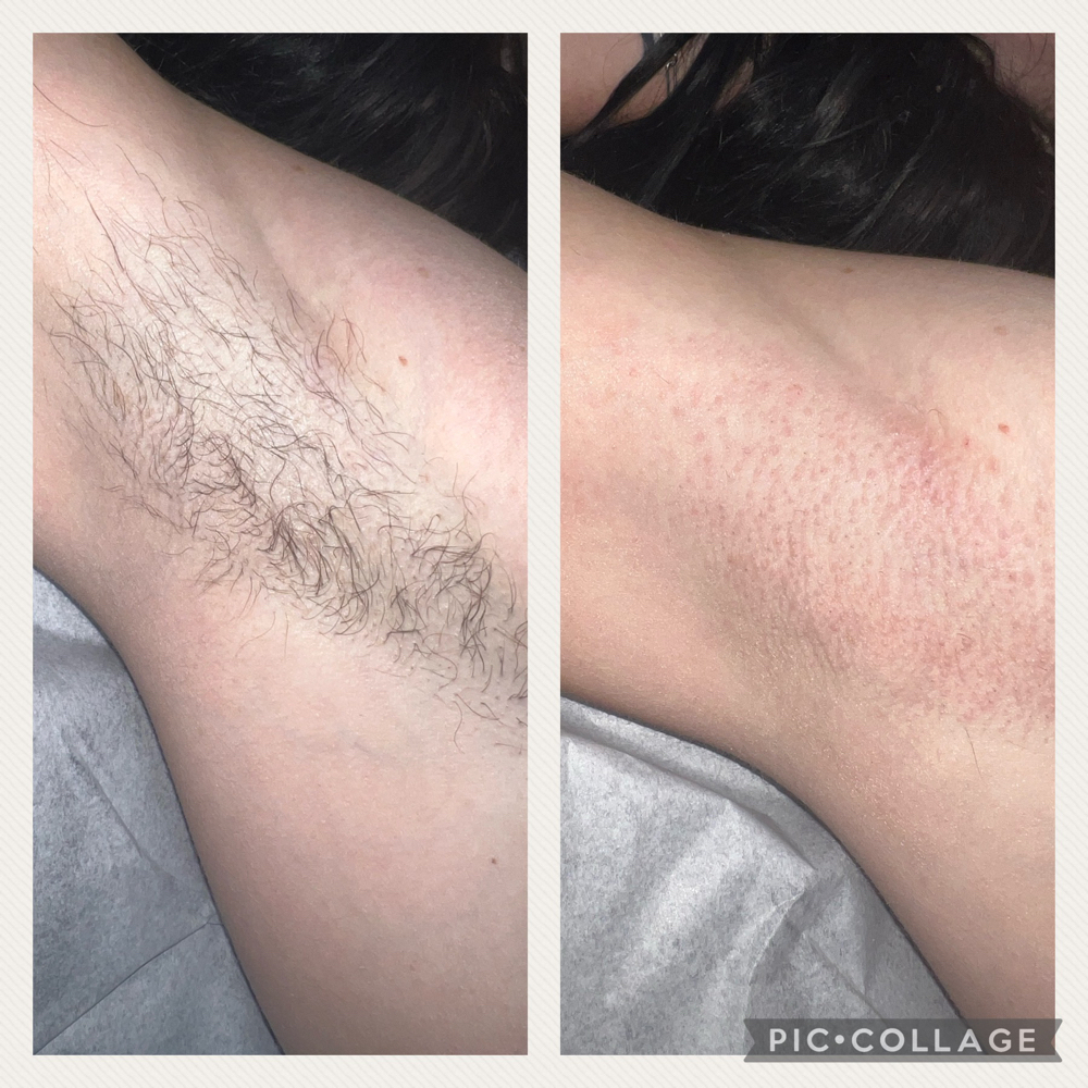 Underarm Wax