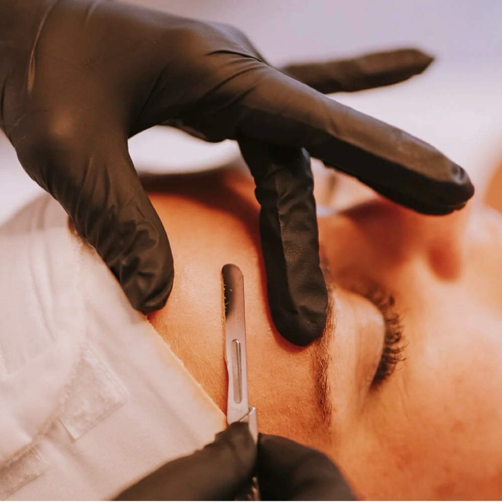 Dermaplaning at Metamorphosis Med Spa in Lafayette, CO