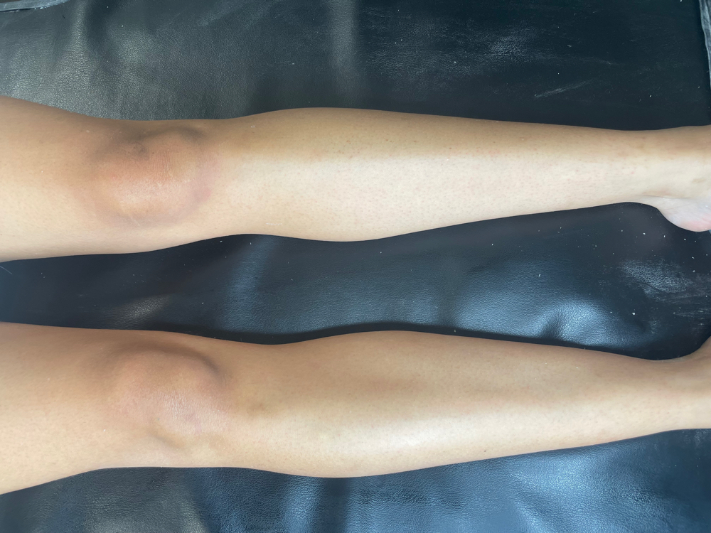 Full Leg Wax
