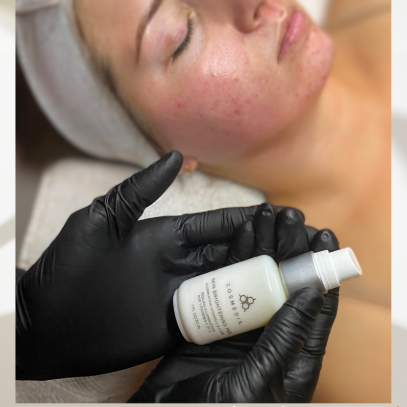 Custom Reset Solutions (Peels) at Bio Skin Aesthetics in Boise, ID