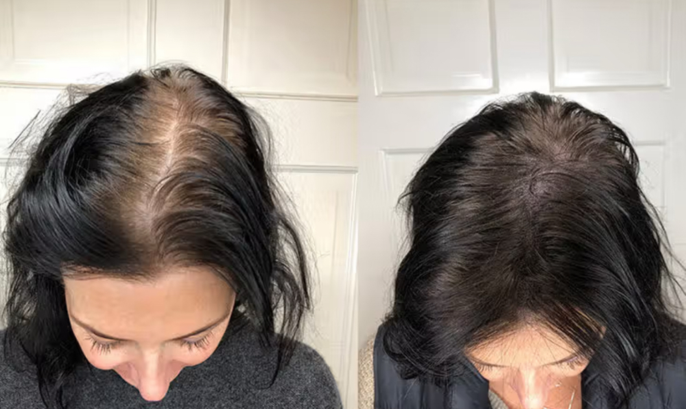 Scalp Painting