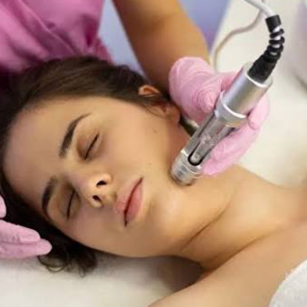 Meso Facial at Sculpting Beauty by Pam LLC in Atascocita, TX