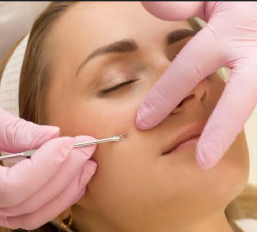 Deep Pore Cleansing at Rosiane Delicoli Skincare in Lafaytte, CA