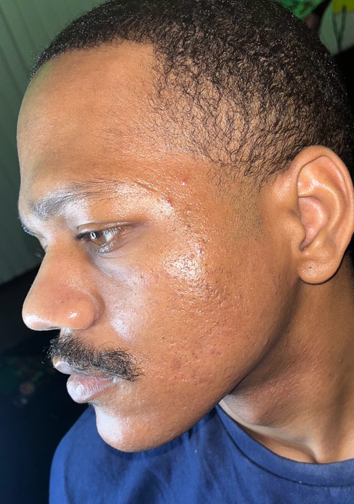 Full Face Wax