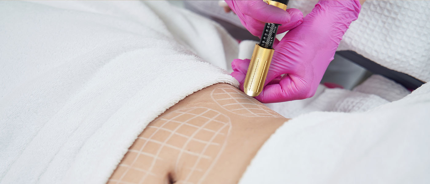 No Needle Fat Dissolving/cavitation at Polished Physique in HOBOKEN, NJ