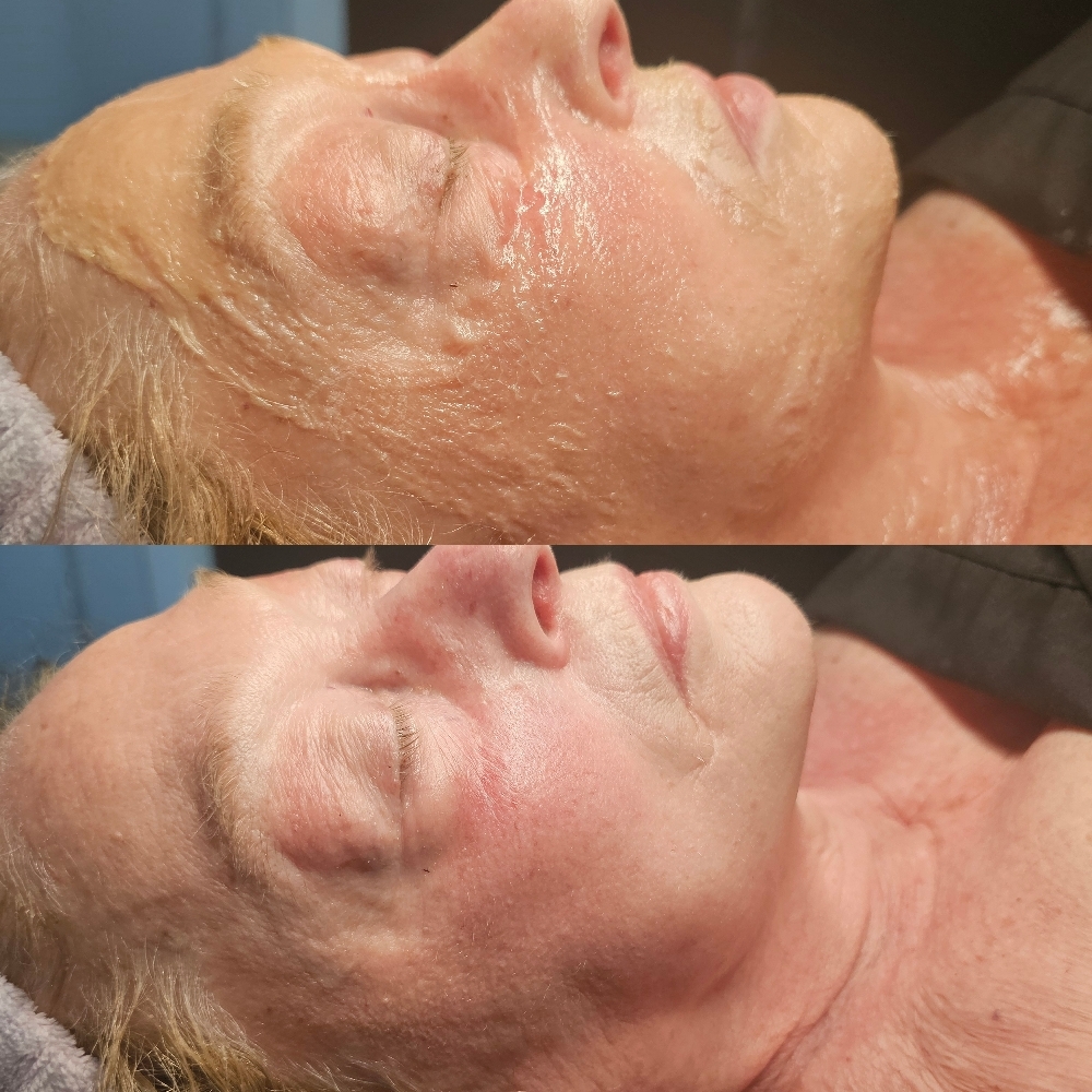 The PRO-Aging Facial at Aligned Beauty & Wellness in Davenport, IA