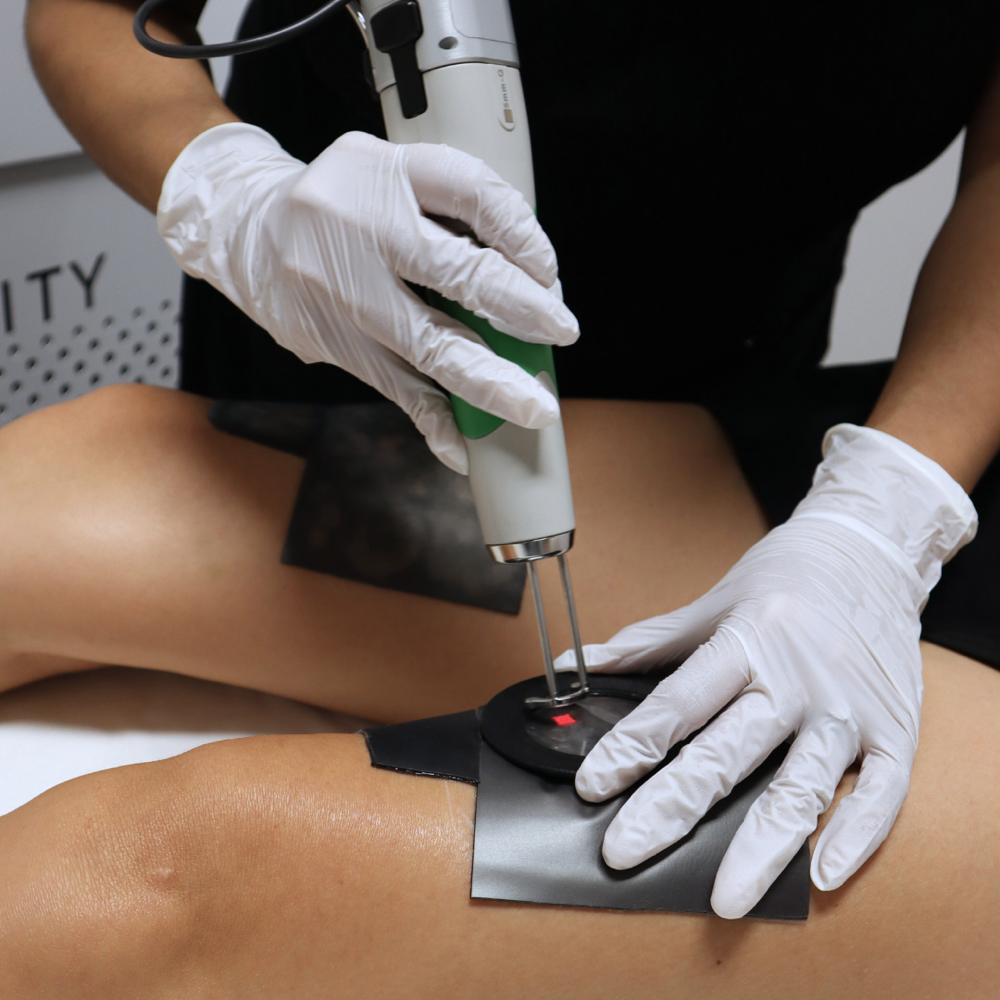 Cellulite Treatment