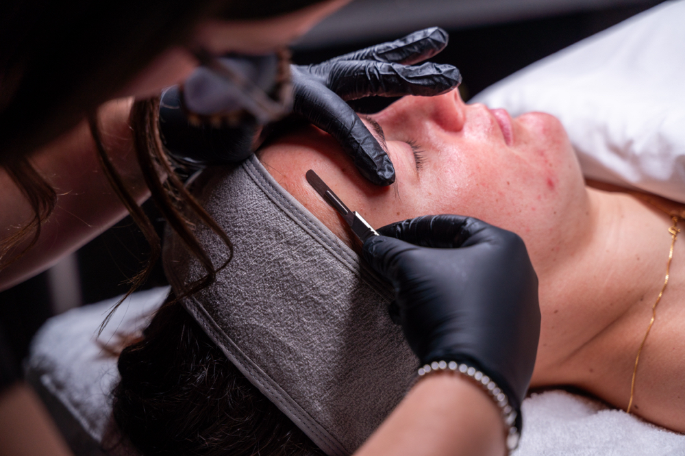 Dermaplane ADD ON