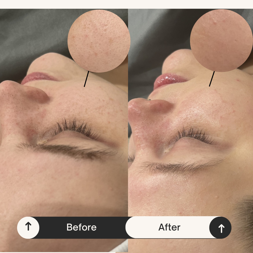 (SPRINGFIELD) HydraGlow Facial