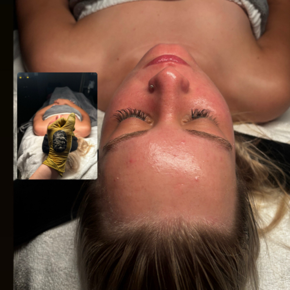 Mini Dermaplane Facial at Sweet Skin Studio in San Antonio (Castle Hills ), TX