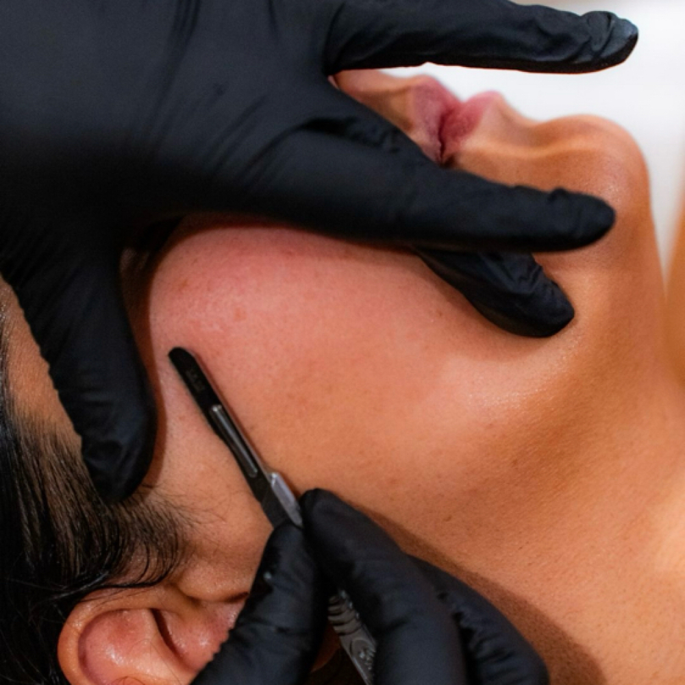 Facial + Dermaplaning at ENDLESS BEAUTY AESTHETICS LLC in Grand praire, TX