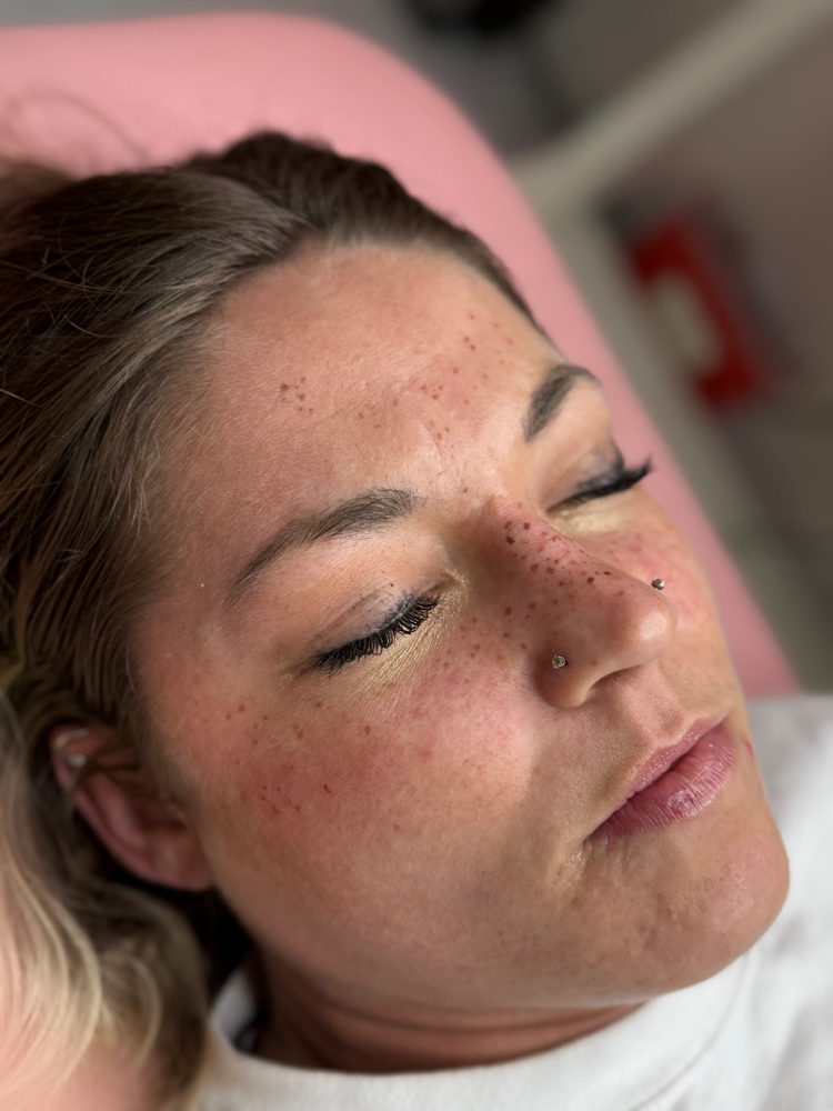 PMU Freckles