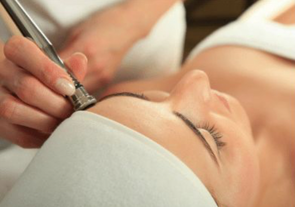 Microdermabrasion Facial