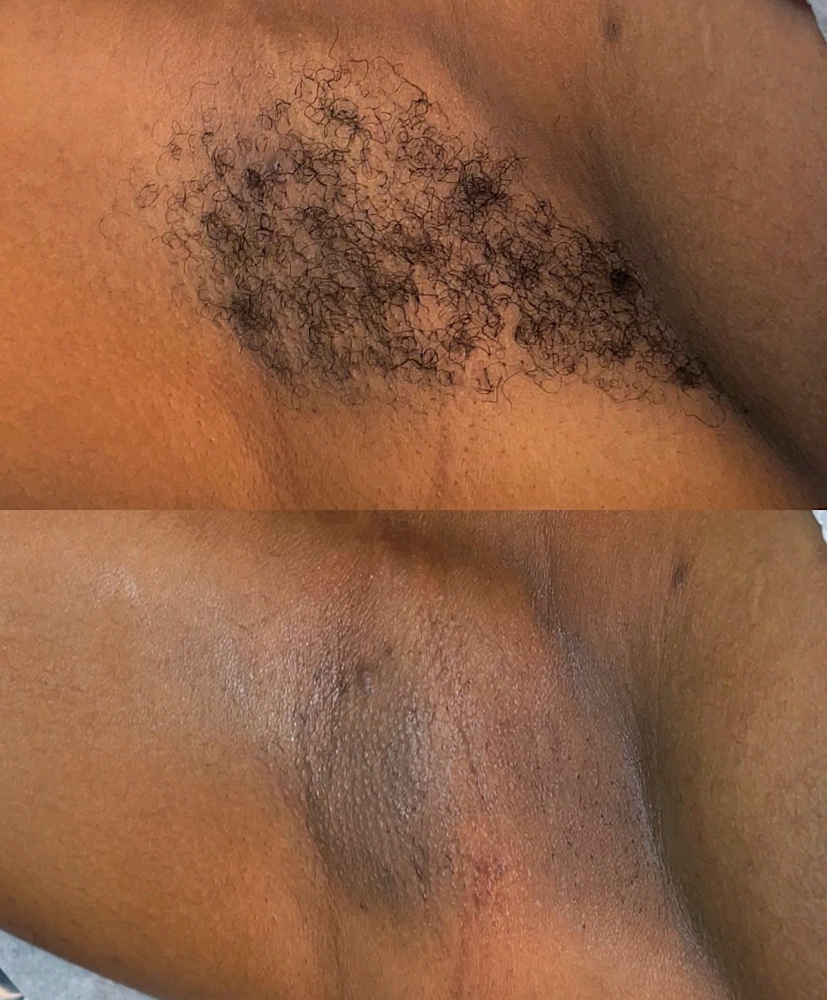 Underarm Wax