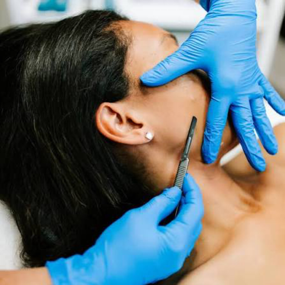 Dermaplaning (add on) at Salty Poppy Aesthetics in Monterey, CA