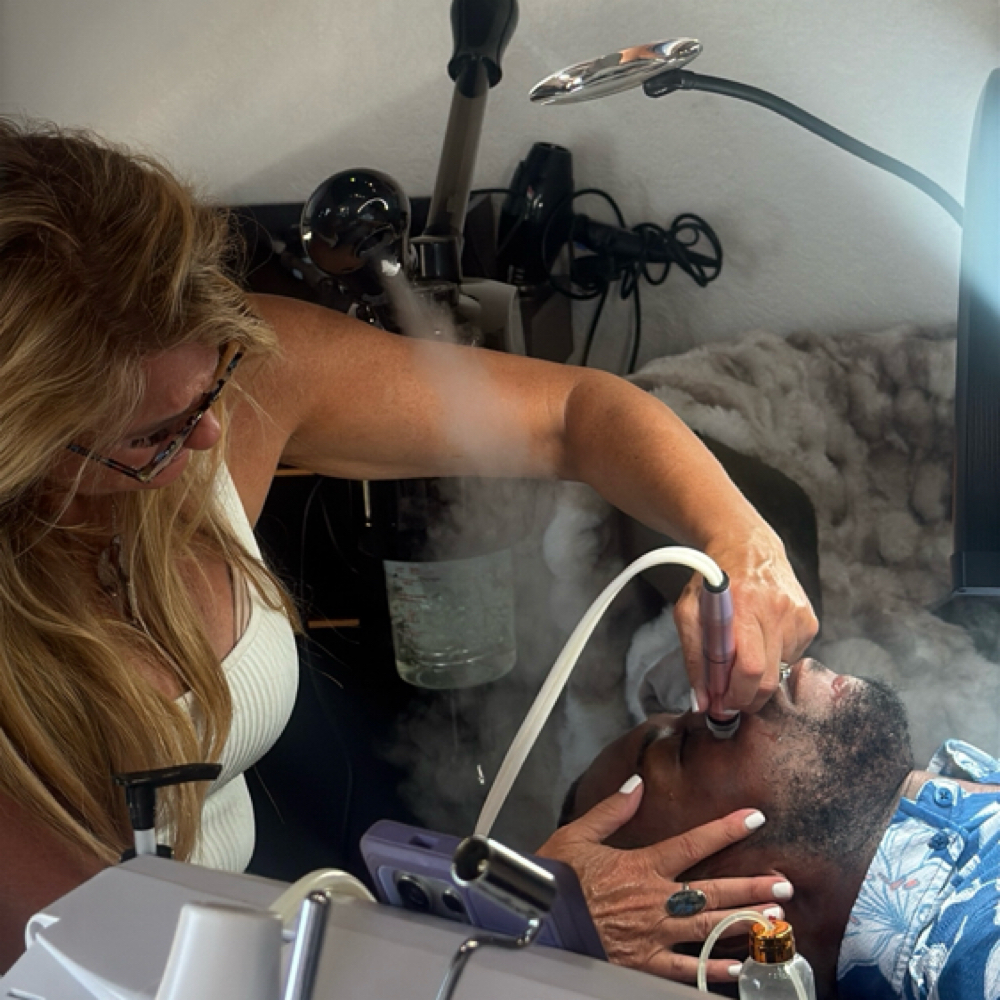 Microdermabrasion at Sev’s Studio in Fort Lauderdale, FL