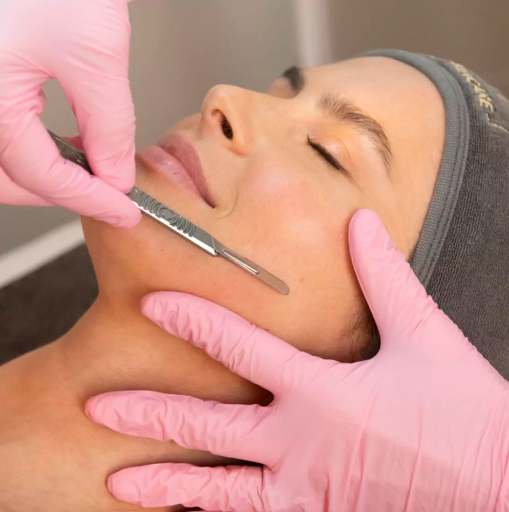 Dermaplaning ADD On