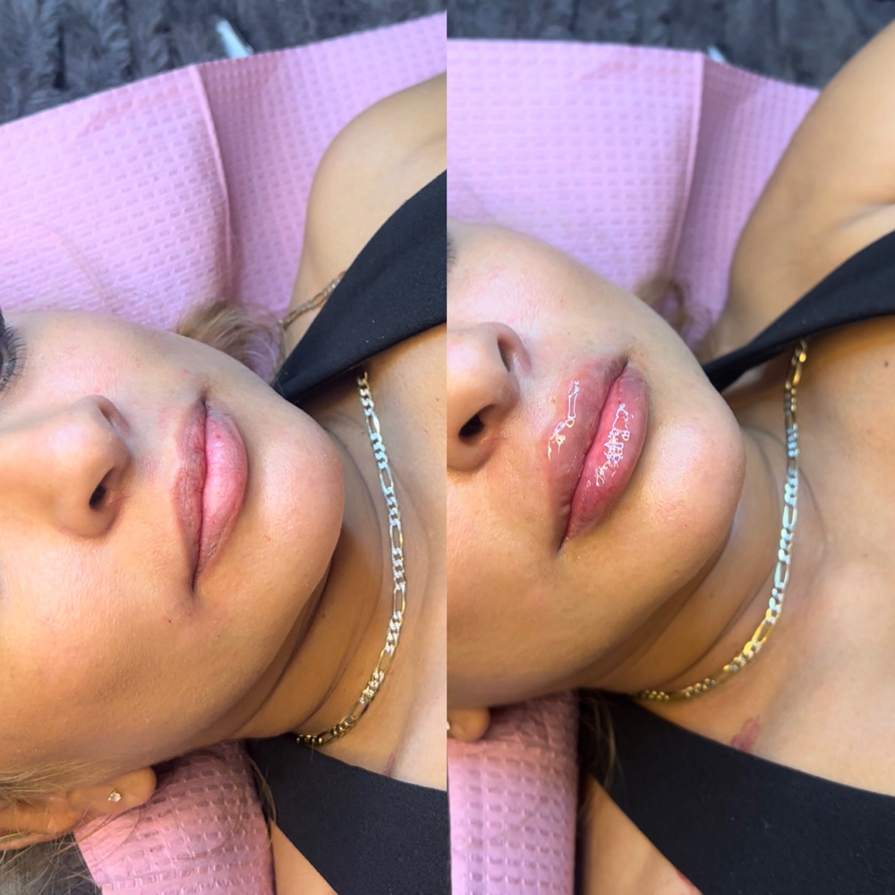 1 ML Touch Up