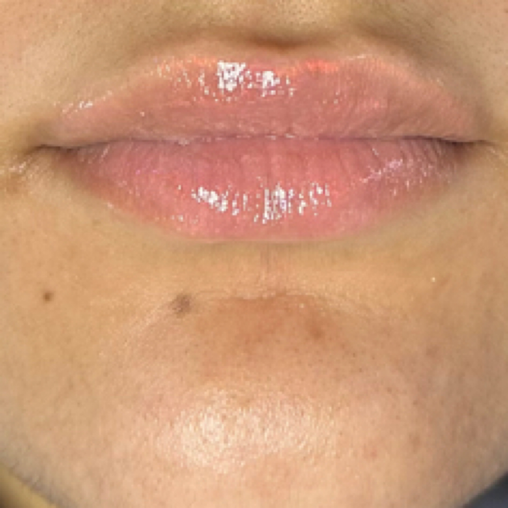 Lip Brightening Treatment at Rooted Studio in Manchester, CT