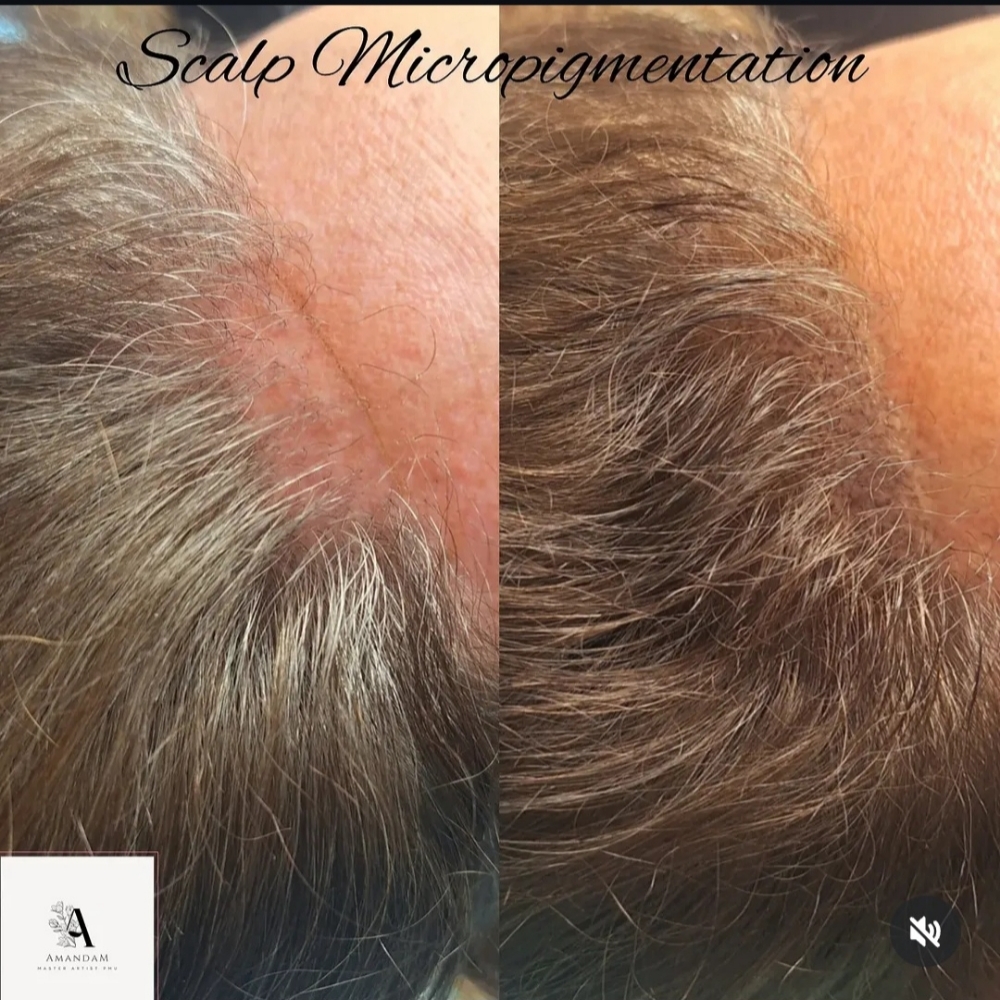 Scalp Pigmentation (soft balding) at Sienna Ray Salon and Spa Estero in Fort Myers, FL