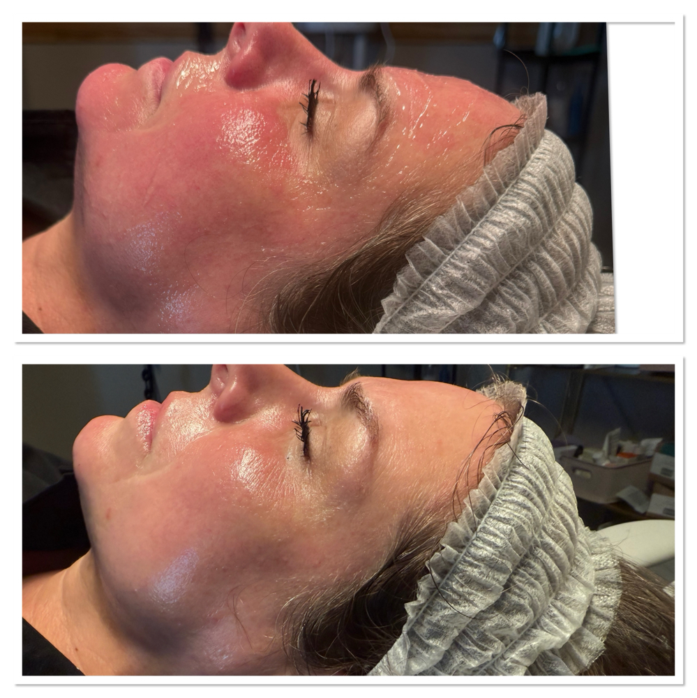 DermaRescue Facial at GlowHaus Collective By Monét in Camden, AR