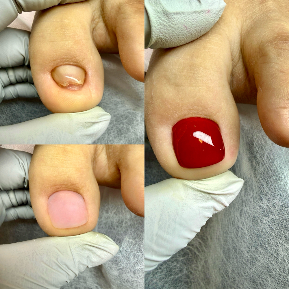 NEC® Nail Reconstruction at Look At My Nails in Chicago, IL