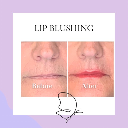 4-8 Week Touch Up (lips)