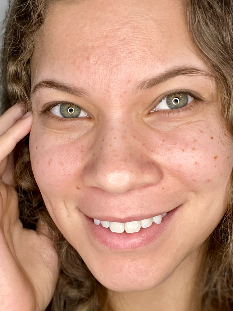 Faux Freckles