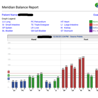 Digital Meridian Imaging