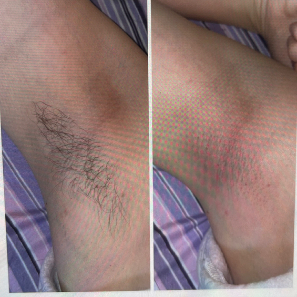 Under Arm Wax at Beauty By Randi in Farmington, MI