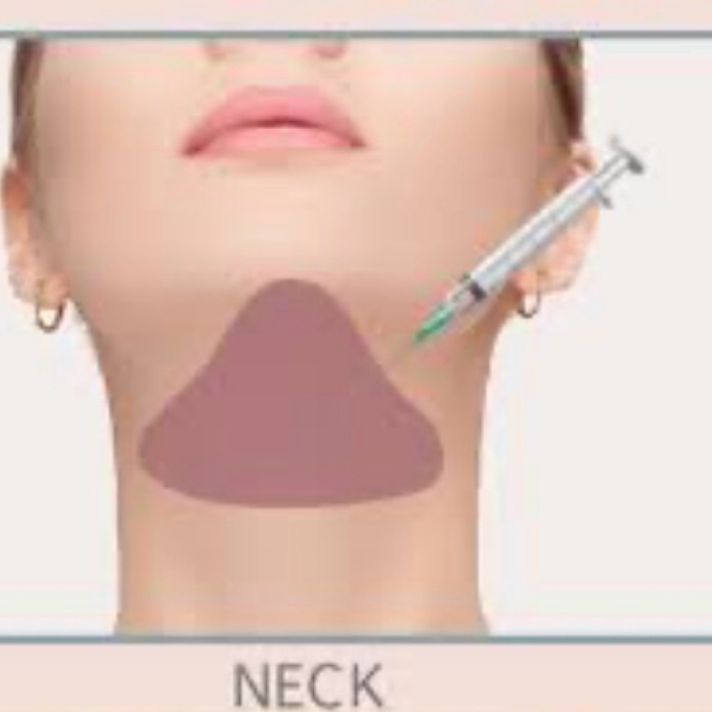 Chin Fat Dissolving at Omni Beauty Bar in Houston, TX