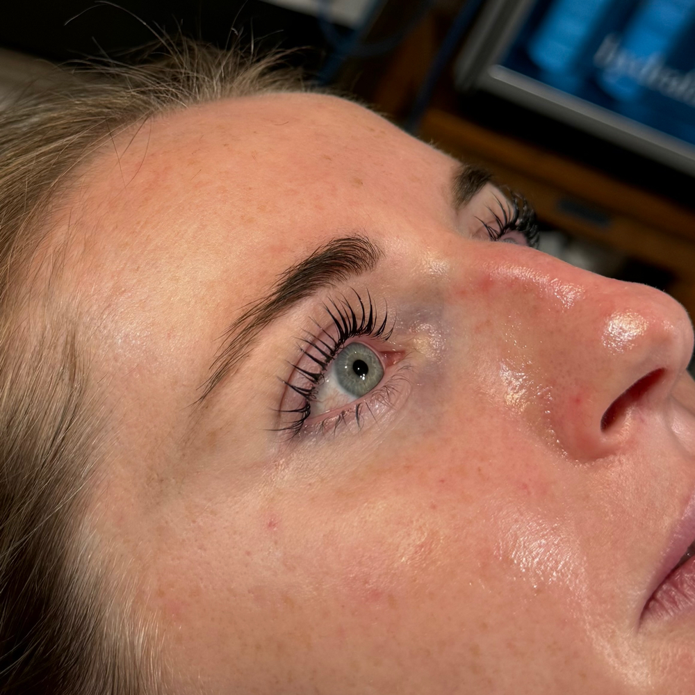 LASH LIFT