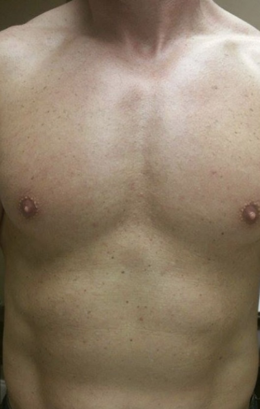 Men Chest Wax