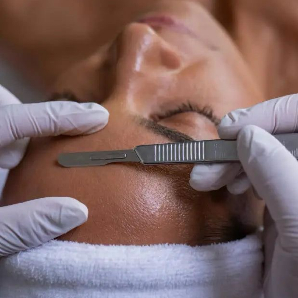 Dermaplaning Facial at Nude Skin Aesthetics in San Pedro, CA