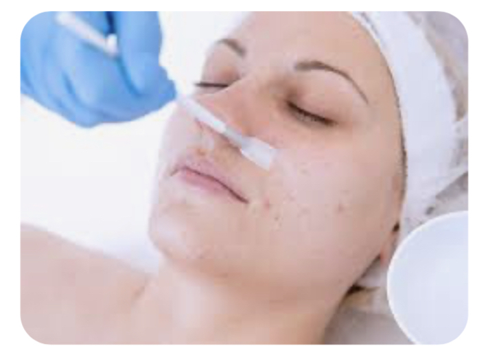 Salicylic Peel (Acne Skin)