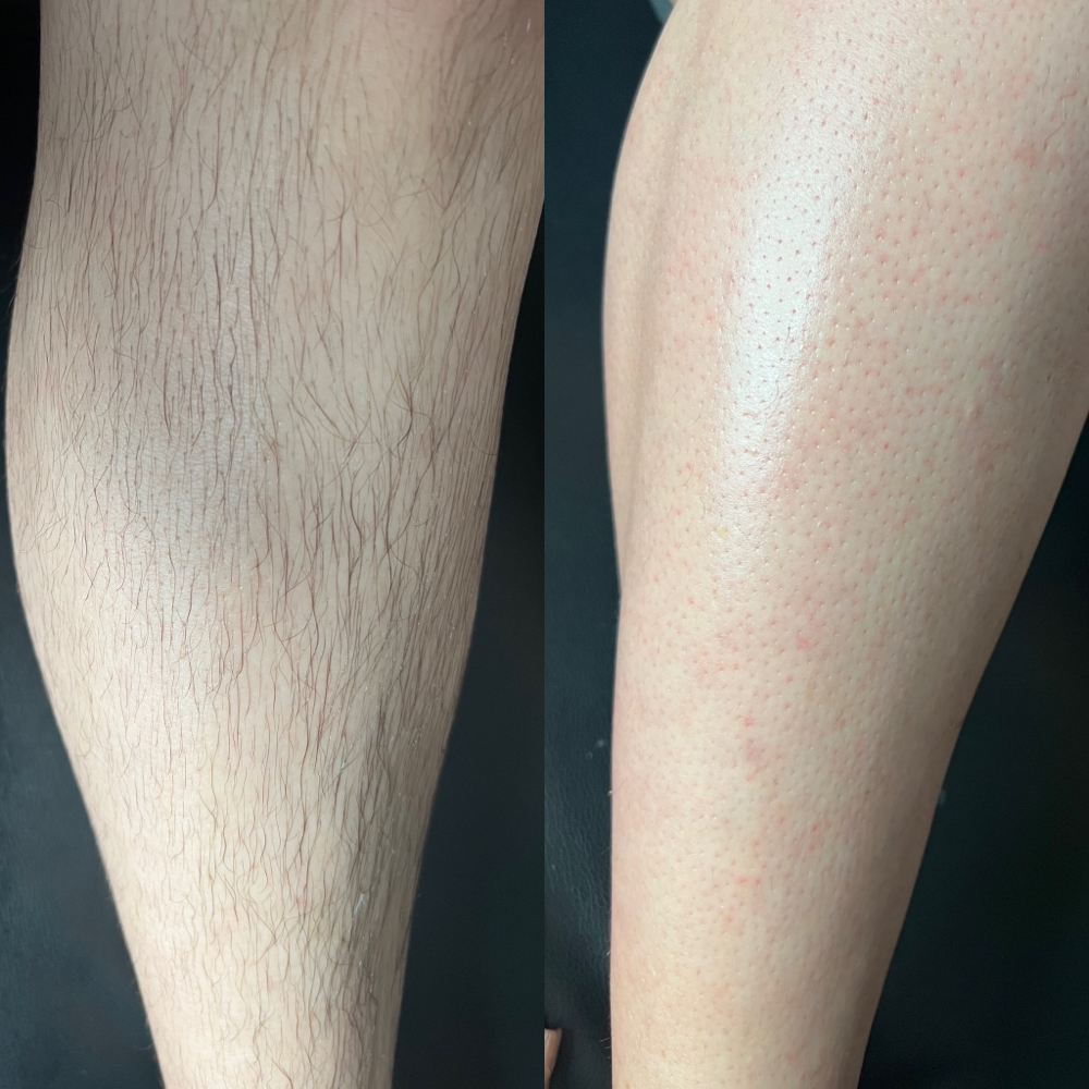 LOWER LEG WAX
