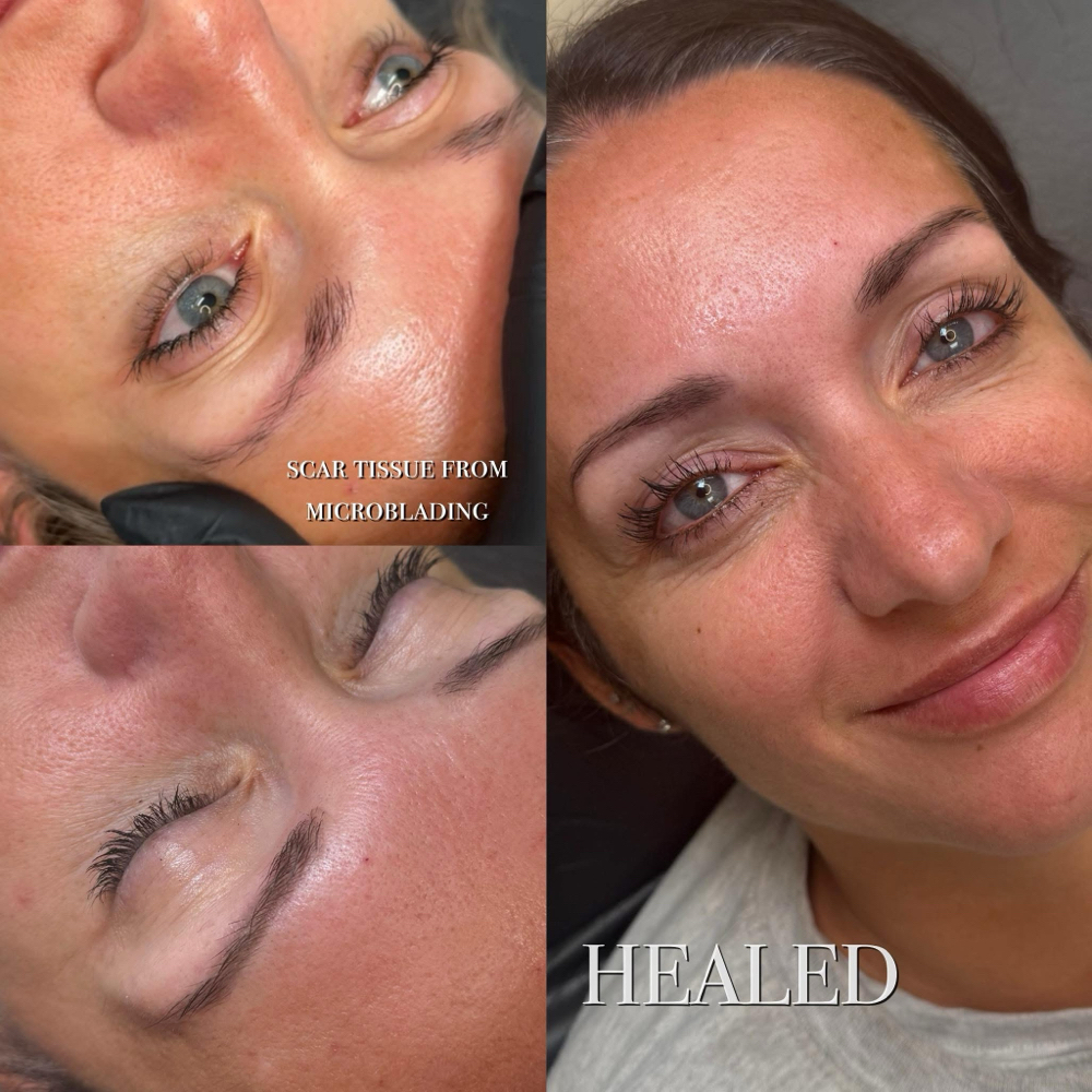 New Client Yearly Touch Up at Aesthetic Beauty Bar LLC in West Chester, OH