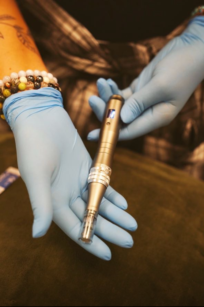 Microneedling
