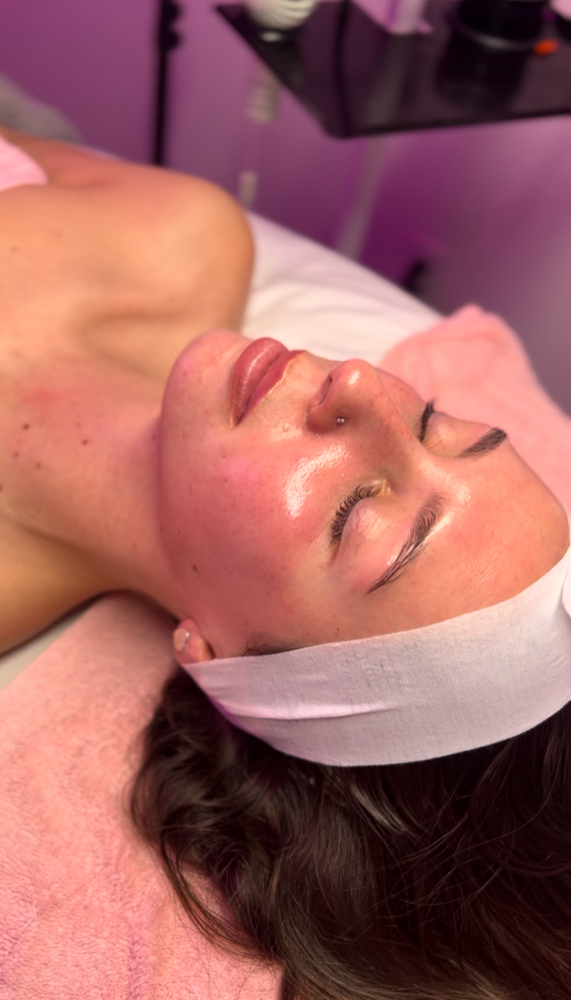 Dermaplaning Facial