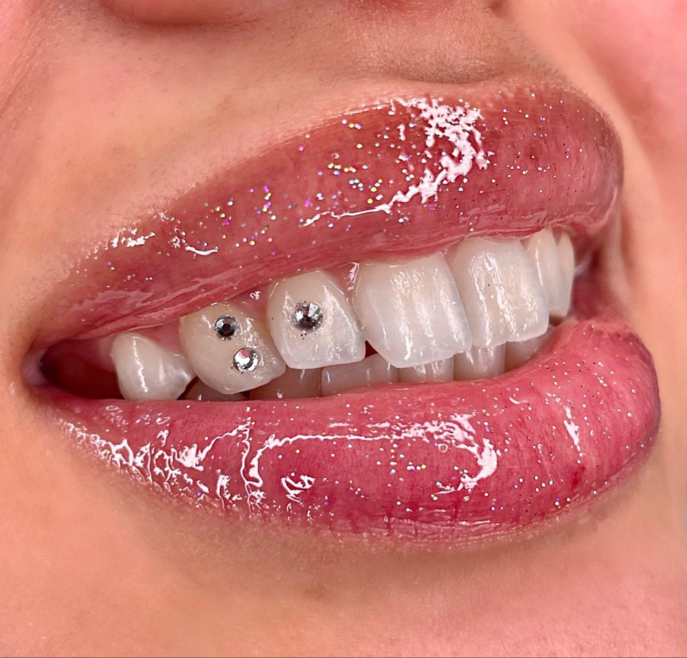 1 Tooth Gem 💎