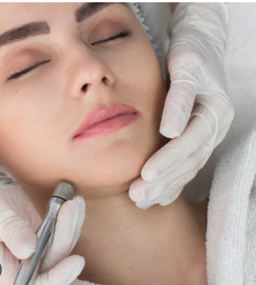 Diamond microdermabrasion Facial