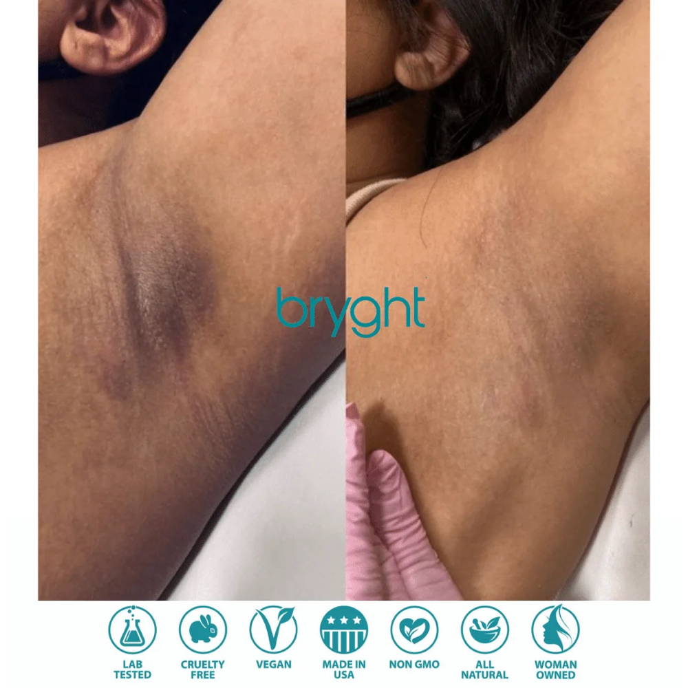 Bryght Treatment (Underarms)