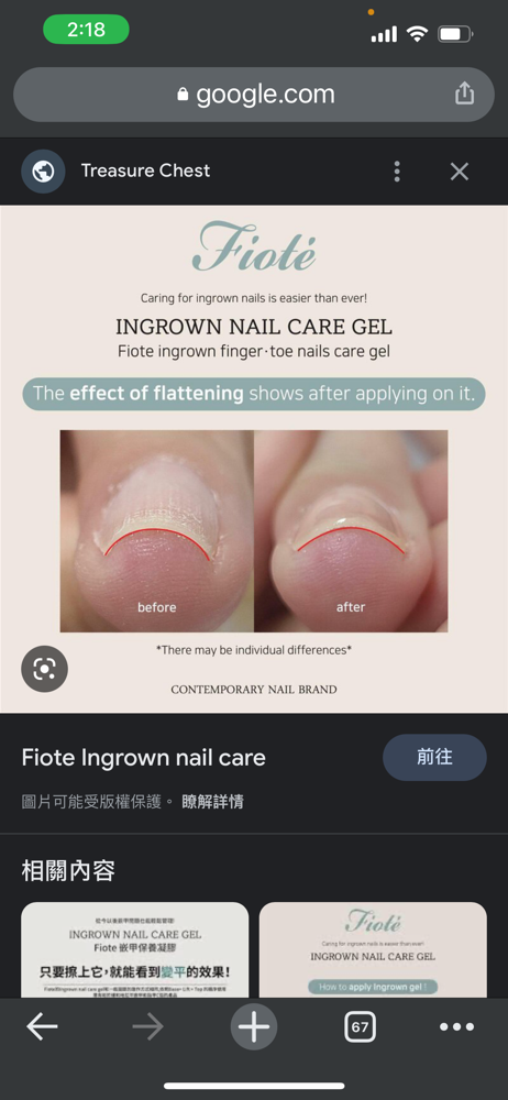 Ingrown Deluxe Pedicure