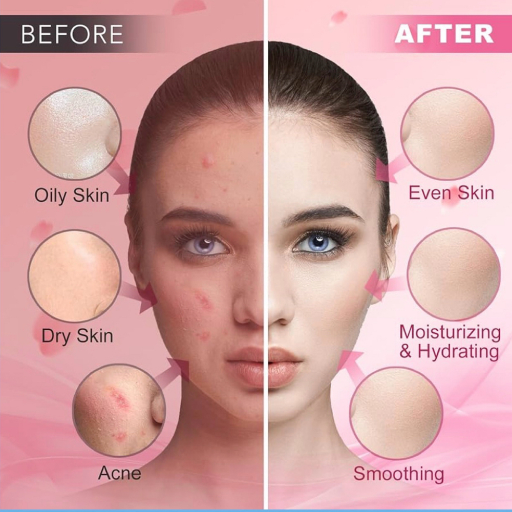 HydroJelly Facial (Monthly Rate)